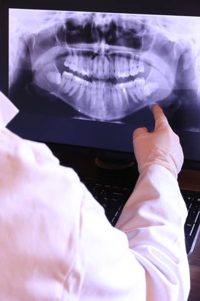 Best Emergency Gum Treatment in Kingsley, IA